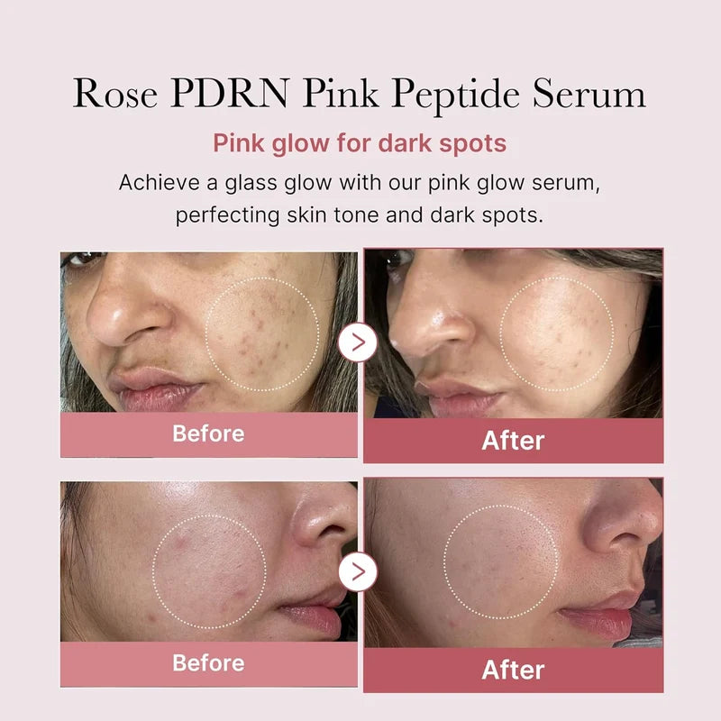 PDRN Pink Peptide Serum 30 ml