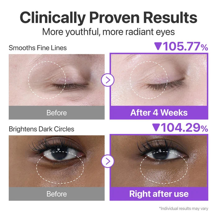 No 9+ Nad + retinol Vlumetoz Eye Cream 10 ml